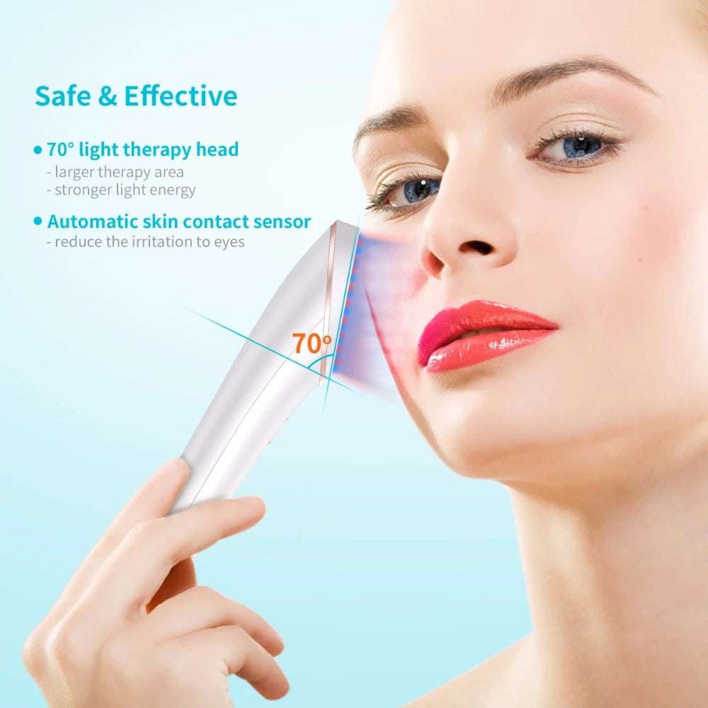 Acne Light Therapy Xpreen Wireless Rechargeable Light Acne Treatment Device Acne Clearing Eraser with Blue Light and Red Light - Minihomy